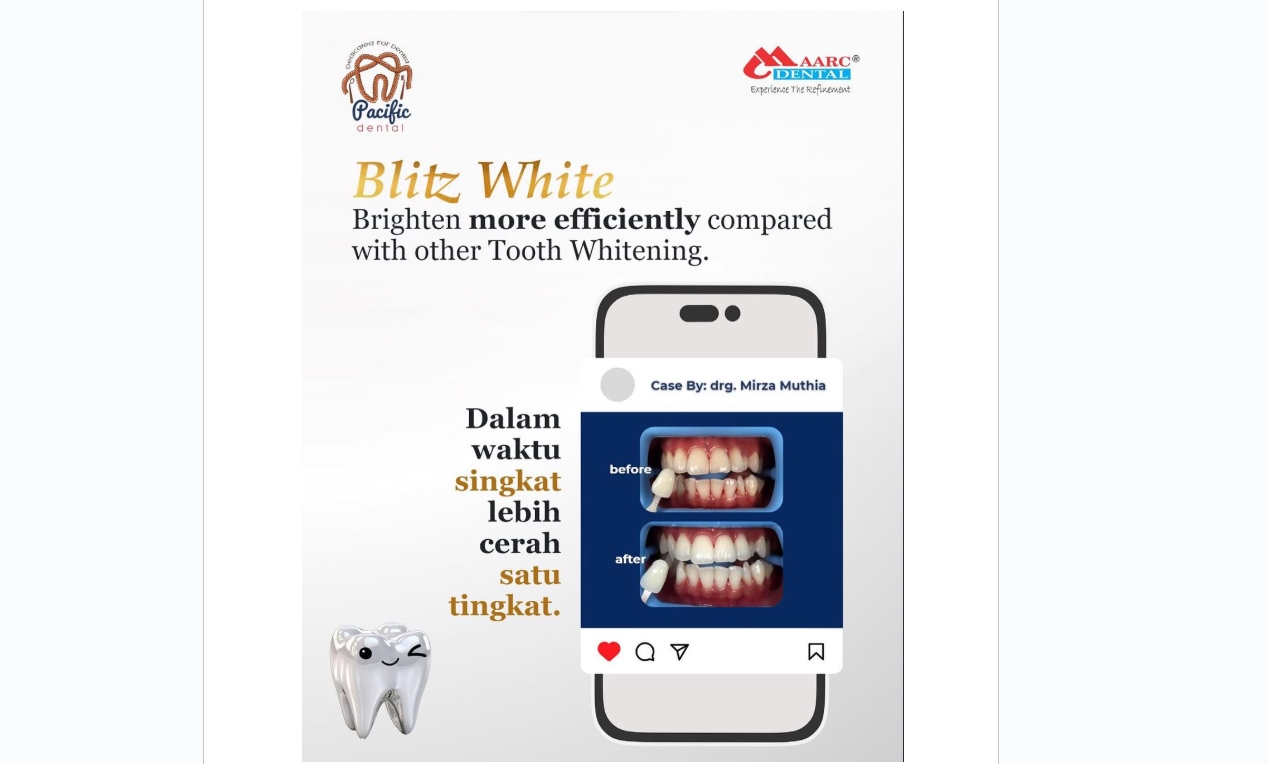 Optimalkan perawatan gigi Anda dengan produk Maarc Dental dari Pacific Dental. Temukan berbagai produk endodontik berkualitas tinggi seperti MTA, CeraSeal B, dan lainnya. Distributor resmi Maarc Dental di Indonesia, jangkauan luas, dan layanan profesional